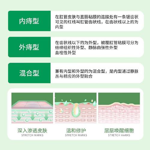 卡波姆的三大优势-卡波姆凝胶多少钱一盒